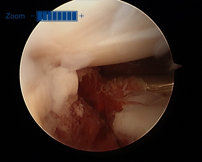 Fig. 16