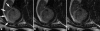 FIG. 8
