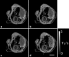 FIG. 7