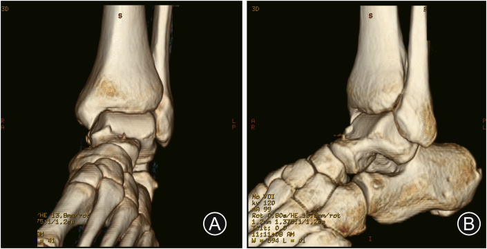 Fig. 3