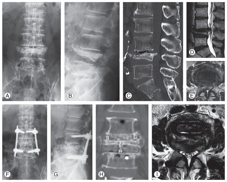 Fig. 5