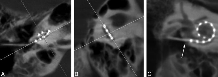 Fig 2.