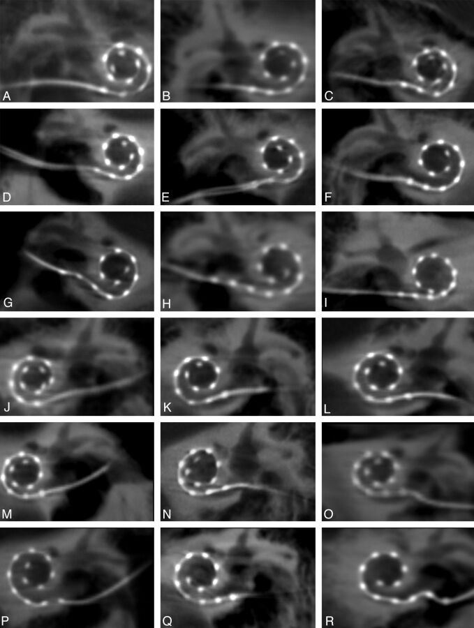 Fig 5.