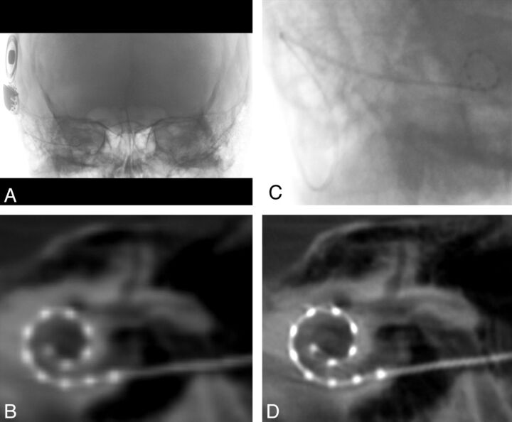 Fig 1.