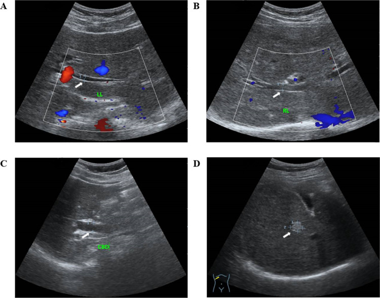 Fig 2