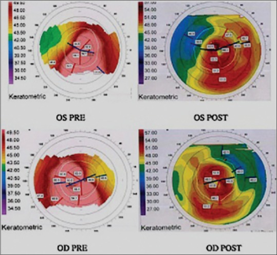 Figure 4