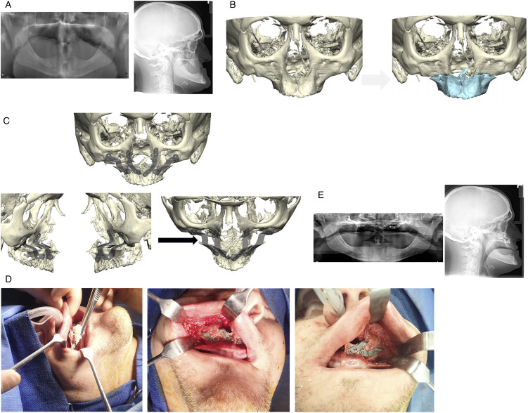 Figure 3.