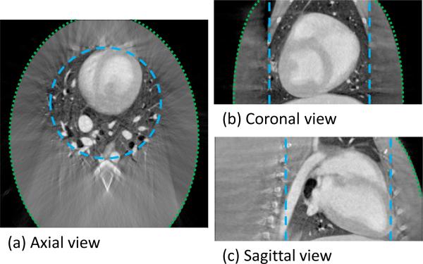 FIG 4