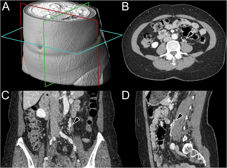 Fig. 1