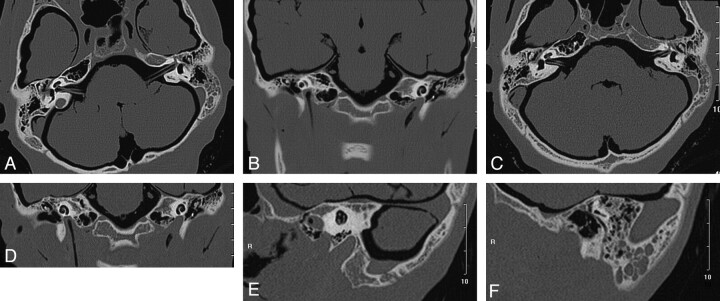 Fig 2.