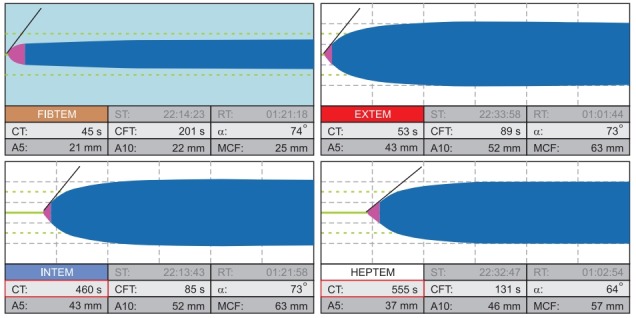 Fig. 6.