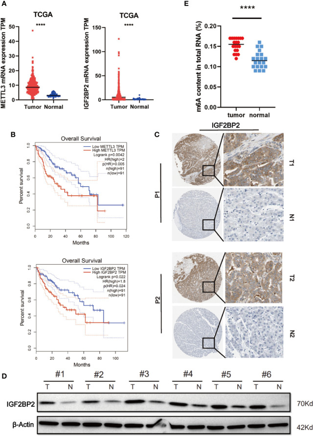 IGF2BP2 Promotes Liver Cancer Growth Through an m6A-FEN1-Dependent ...