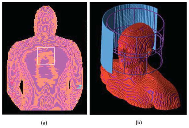 FIG. 1