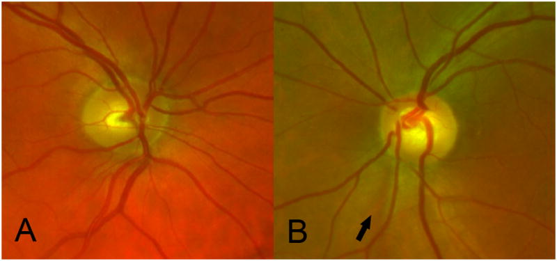 Fig 2