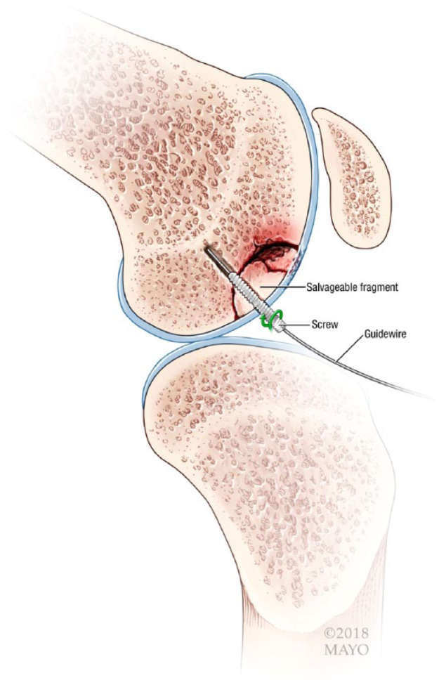 Figure 2.