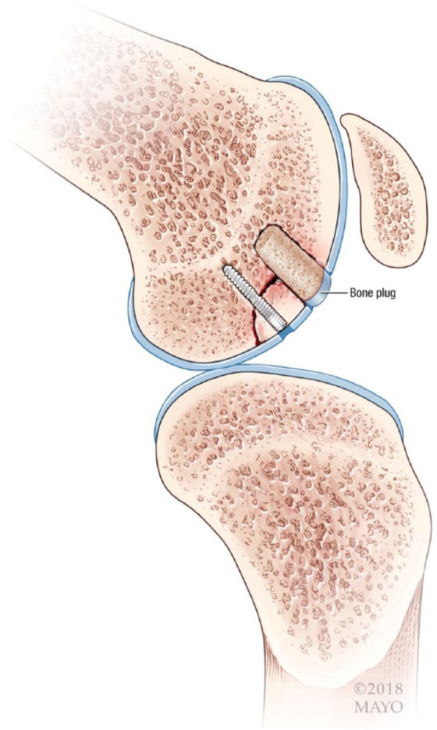 Figure 4.