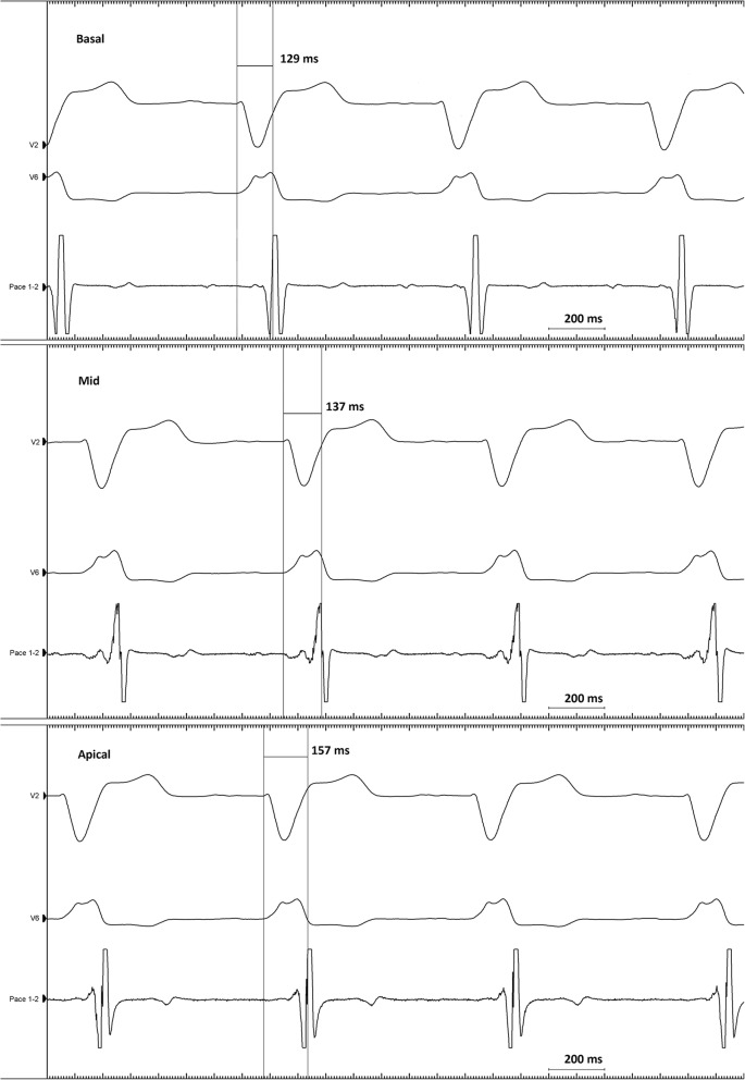 Fig. 3