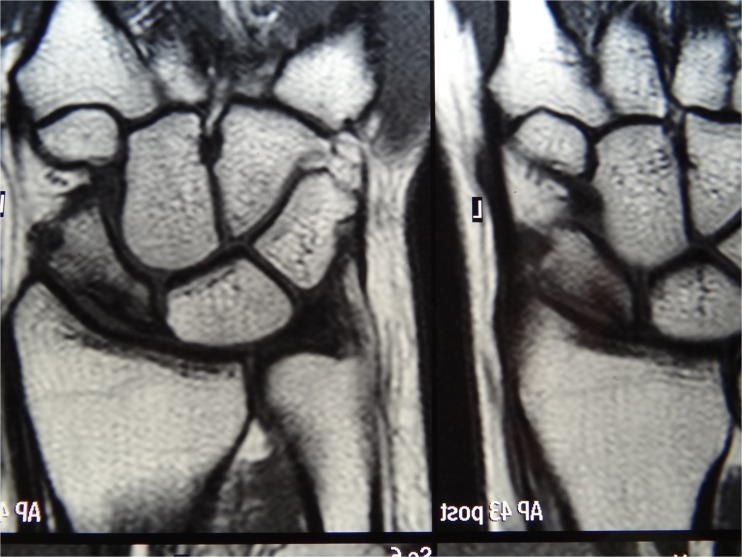 Fig. 10