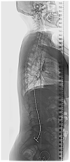 Fig. 12