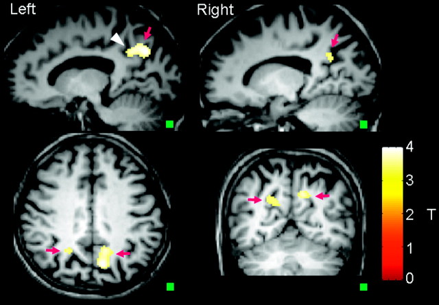 Fig 3.