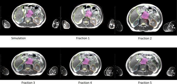 Figure 2