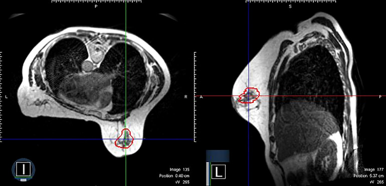 Figure 1