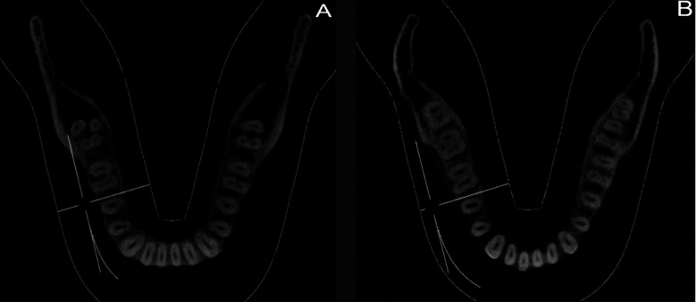 Fig.1