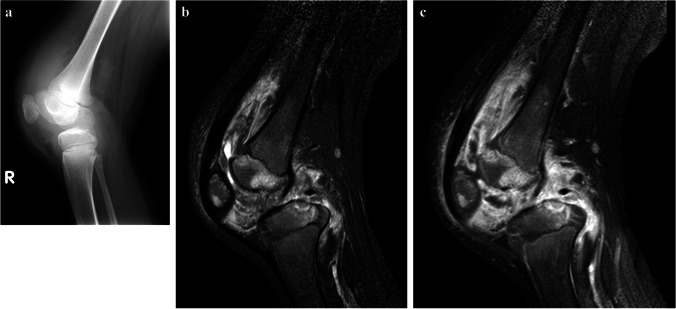 Fig. 38