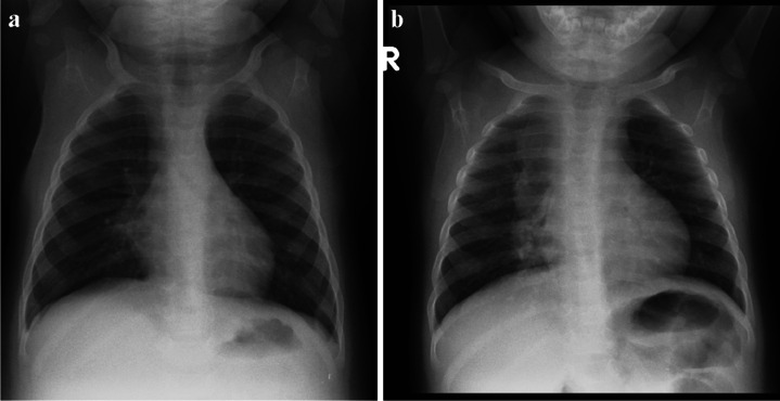 Fig. 11