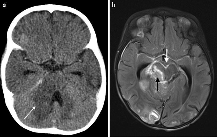 Fig. 15