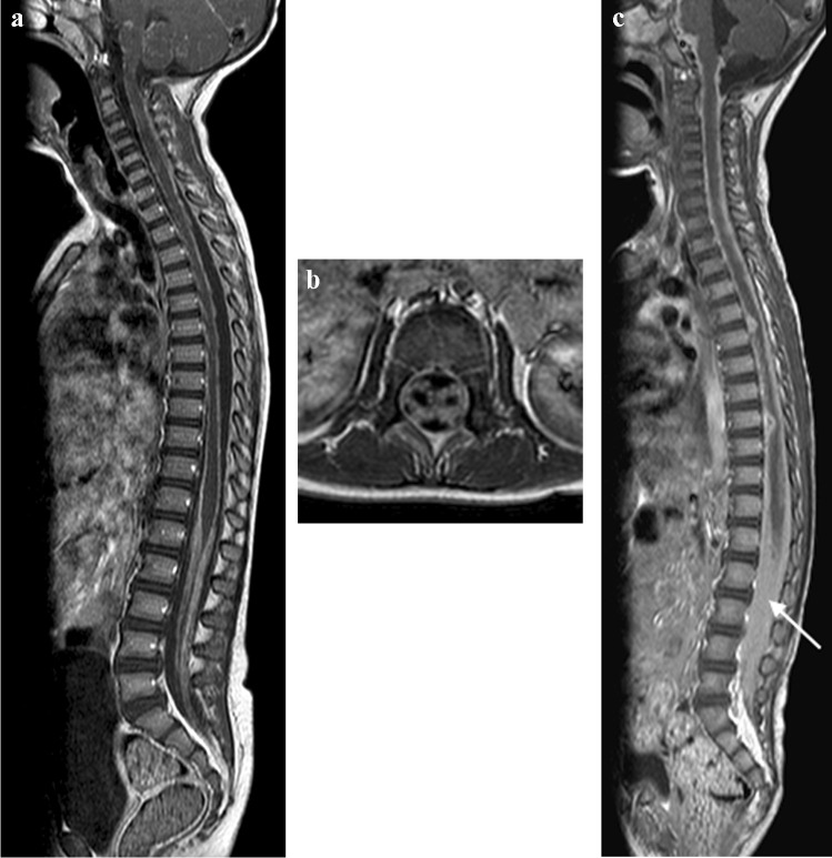 Fig. 24