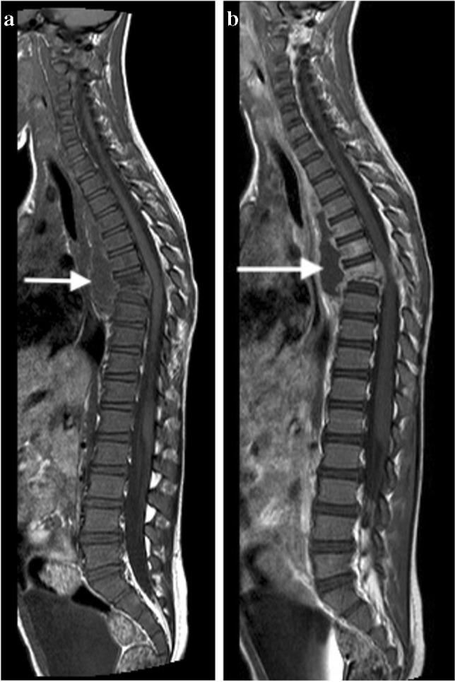 Fig. 33