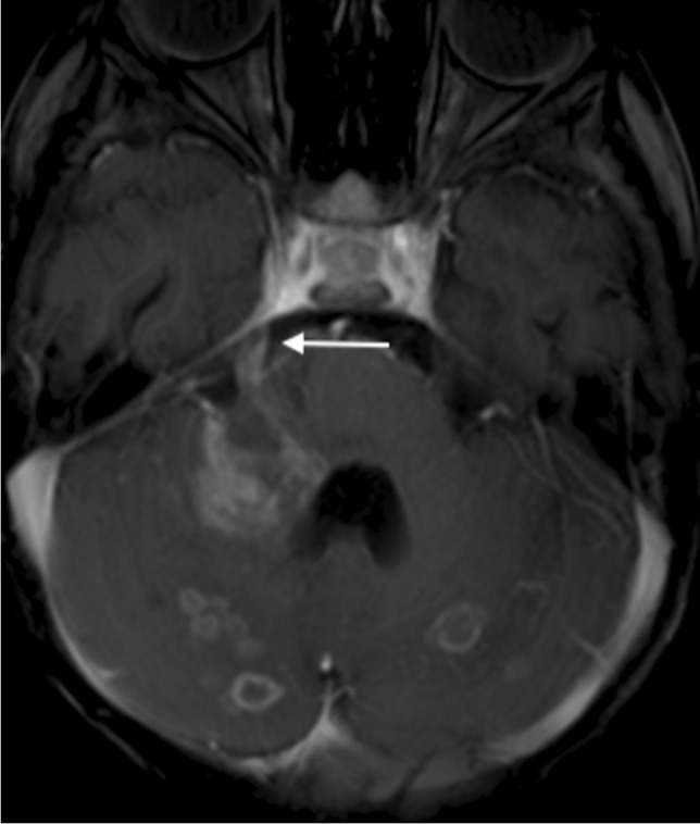 Fig. 20