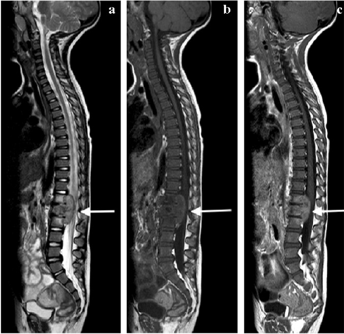 Fig. 31