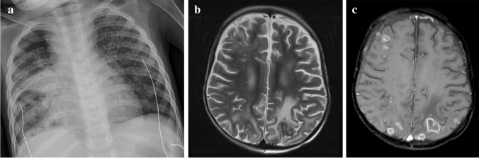 Fig. 22