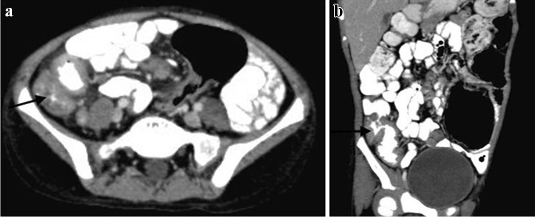 Fig. 43