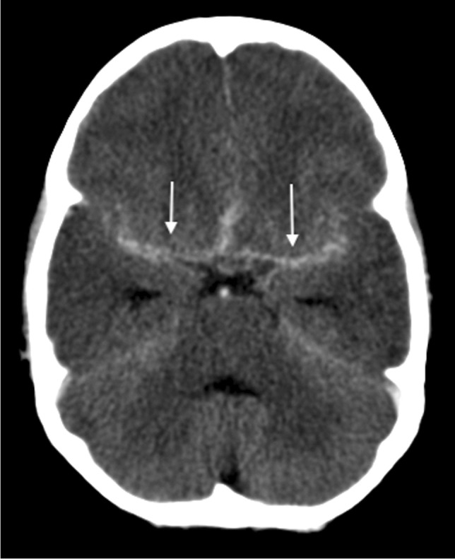 Fig. 14