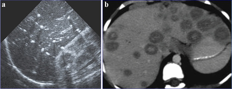 Fig. 42