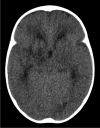 Fig. 18