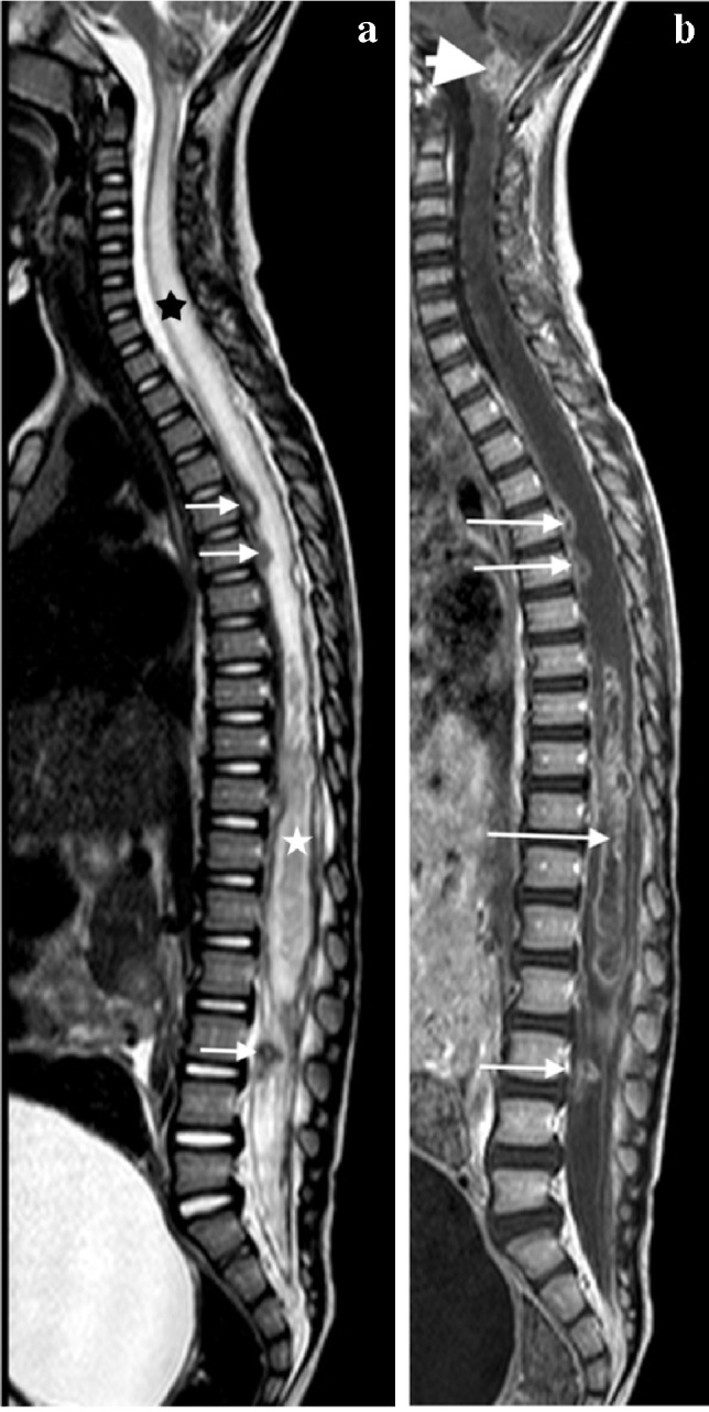 Fig. 25