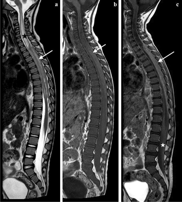 Fig. 26