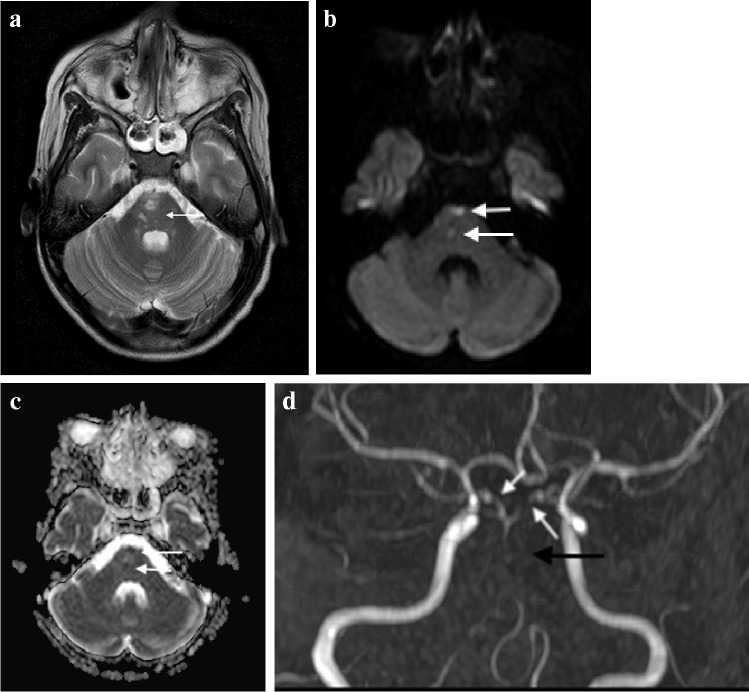 Fig. 19