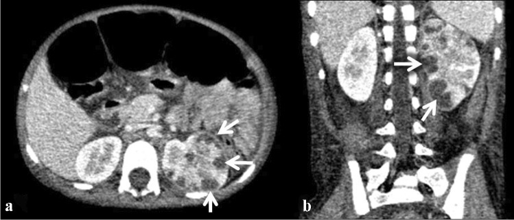 Fig. 45