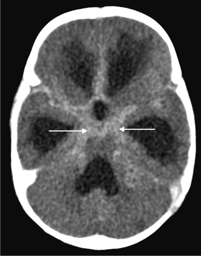 Fig. 13