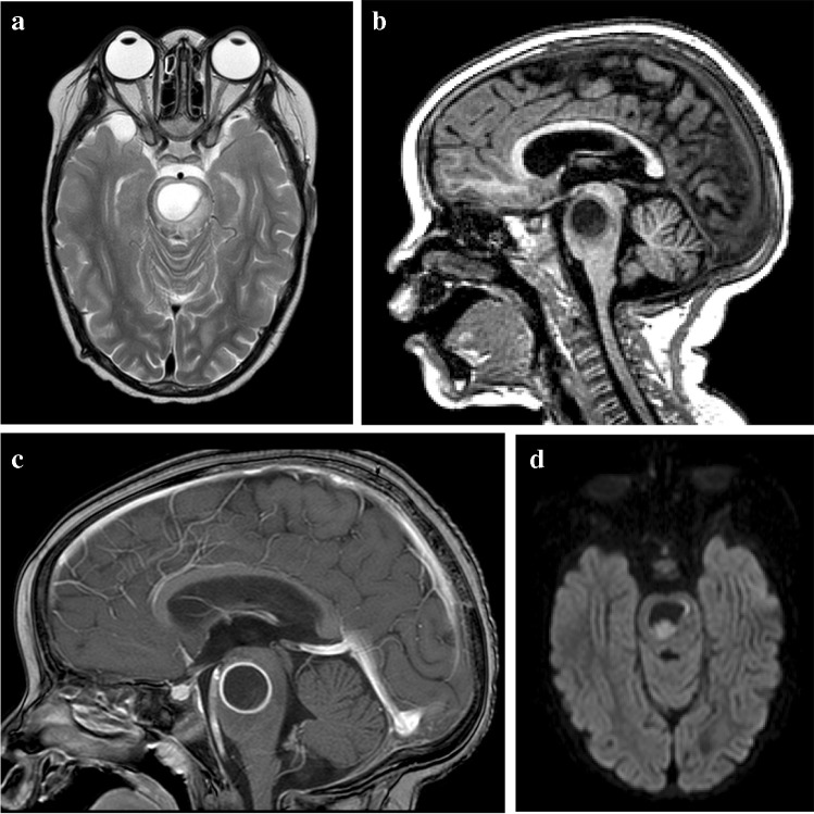 Fig. 23