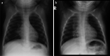Fig. 11