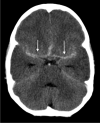 Fig. 14