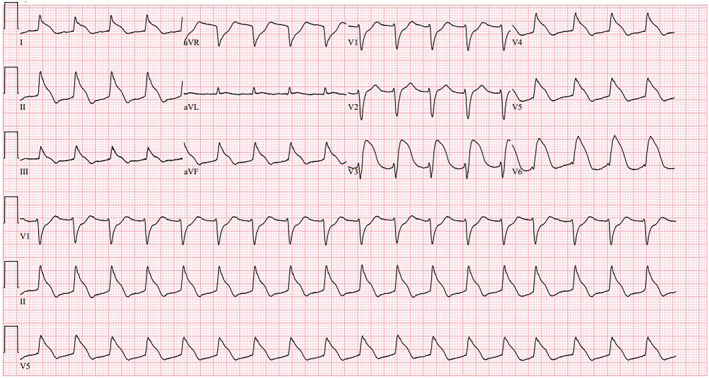 FIGURE 2