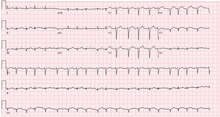 FIGURE 1