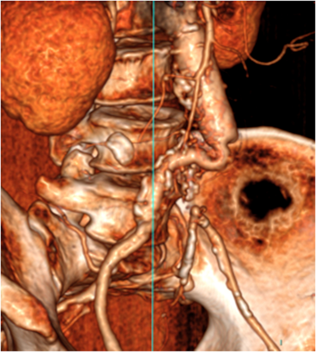 Fig. 2